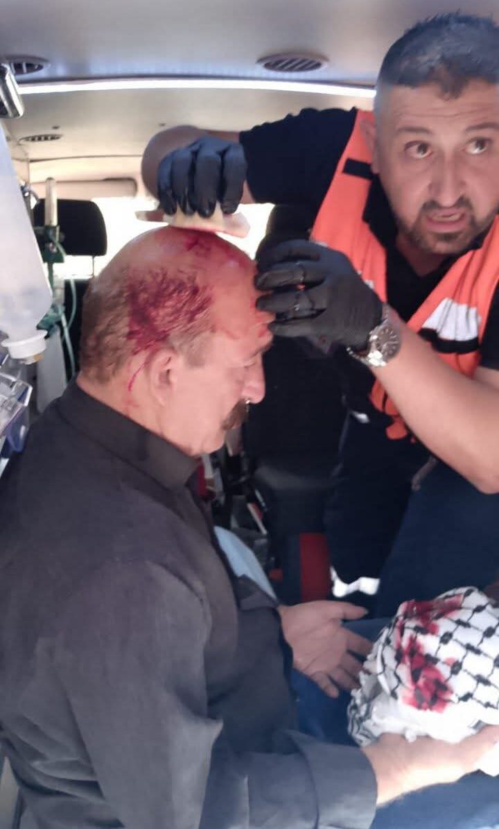 Beta: Abu Nimer was beat up in the head