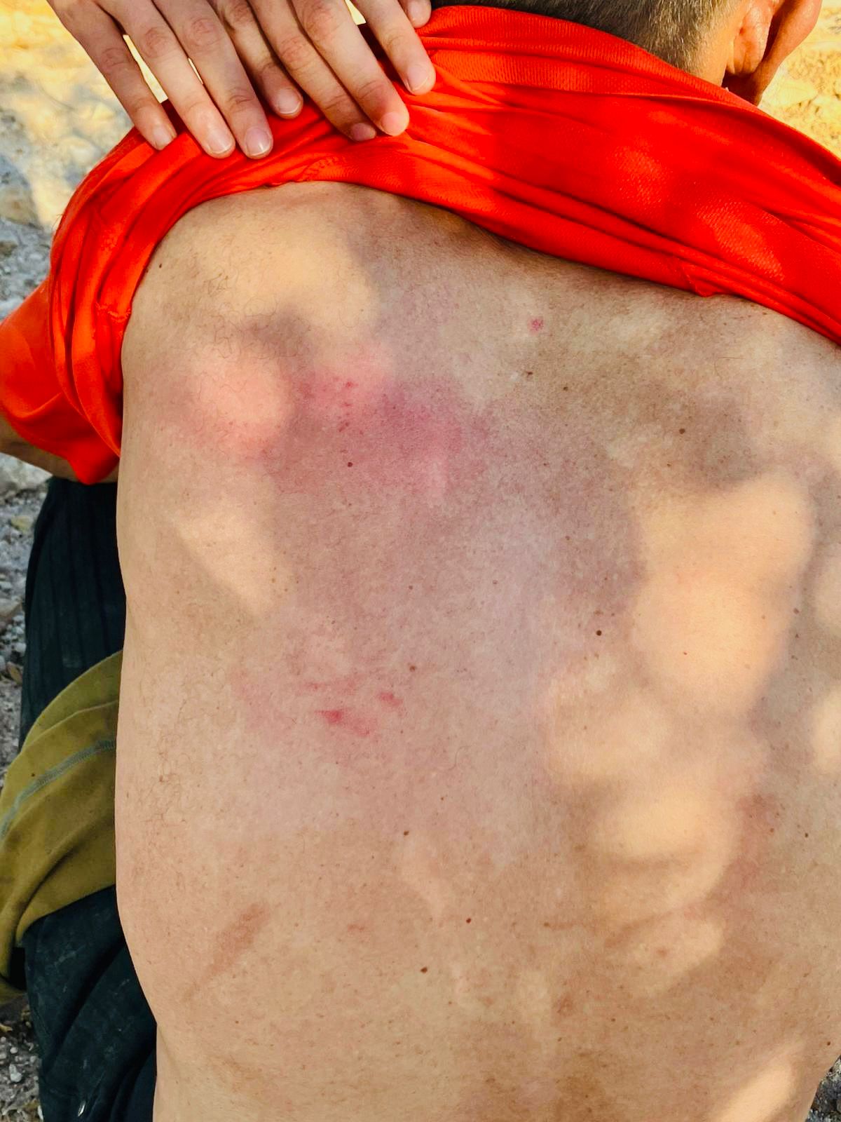 Signs of the beatings the shepherds suffered at the hands of the settlers