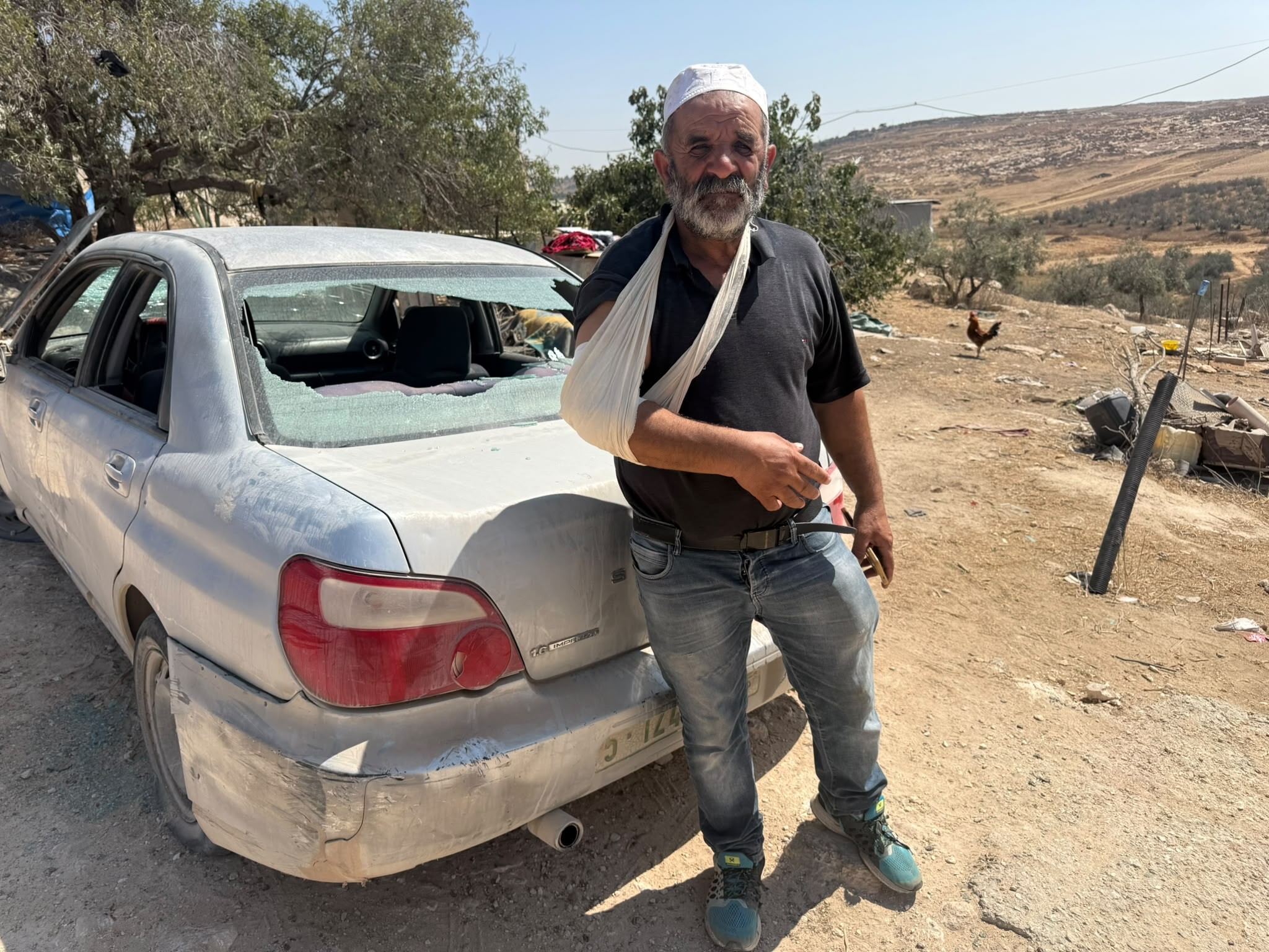 Deir Shams, the destruction done by the settlers and one of the injured